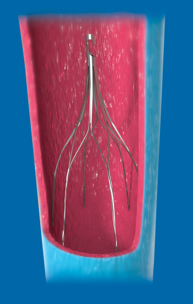 Argon – Vascular – Ferprosa
