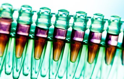 Laboratory research of cancer diseases,  rack with RNA samples